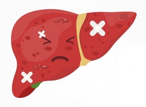 Men gan tăng cao có phải là dấu hiệu của xơ gan, ung thư gan không?